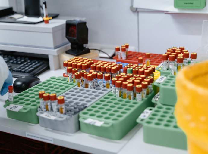 South Africa needs to do more to tackle antimicrobial resistance, warn experts