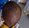 Pupil Survives School Bullying Terror