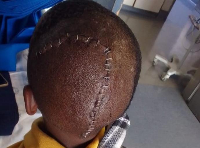 Pupil Survives School Bullying Terror